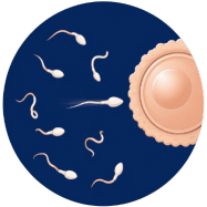 Poor Sperm Motility