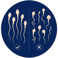 Weak Sperm Quality